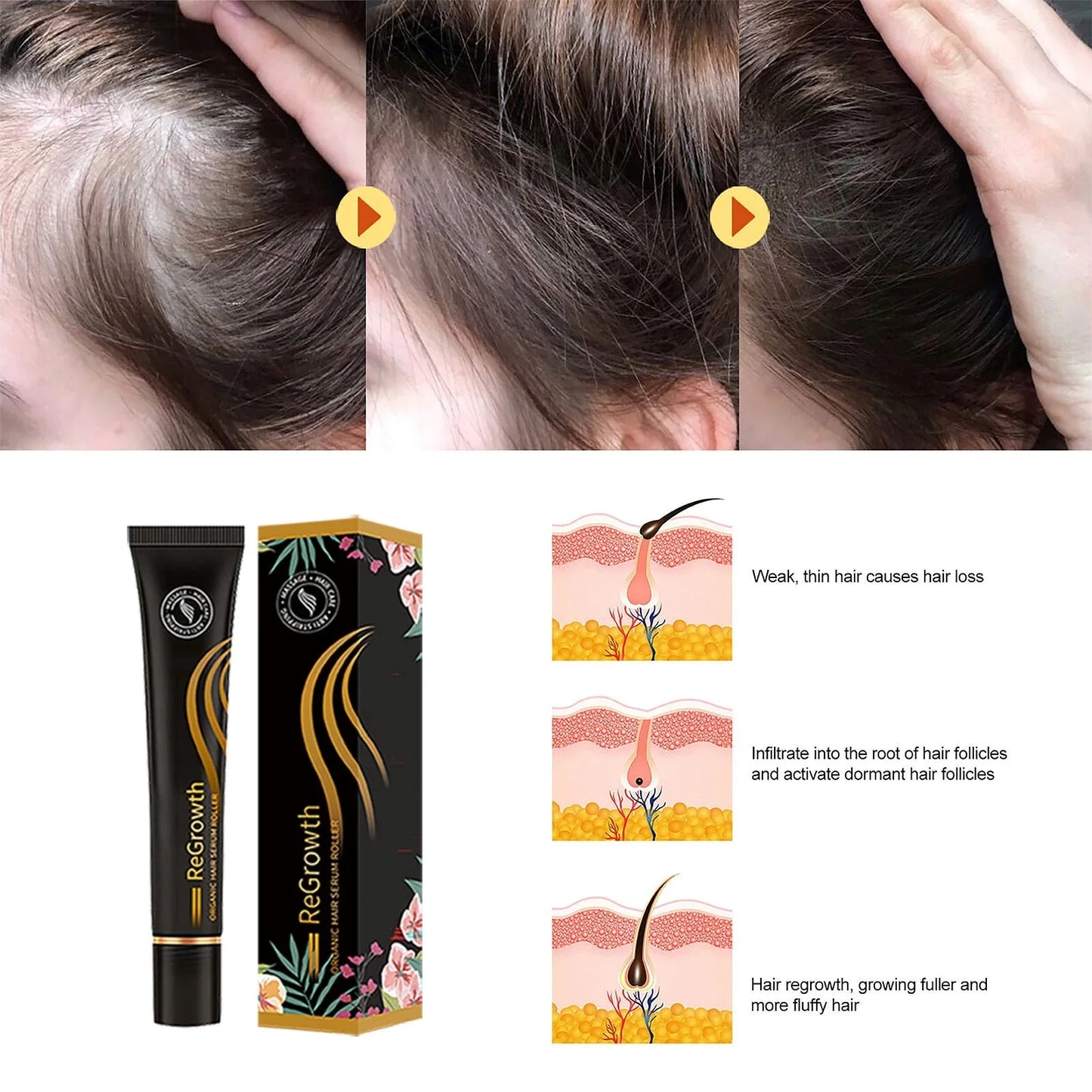 Nourishing Hair Growth Serum with Massage Roller - Revitalize Scalp, Reduce Hair Loss, Promote Healthy Hair Growth