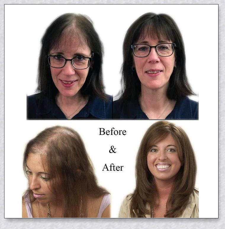 Magic Hair Topper Clip - Discreet Synthetic Hairpiece for Thinning or Graying Hair