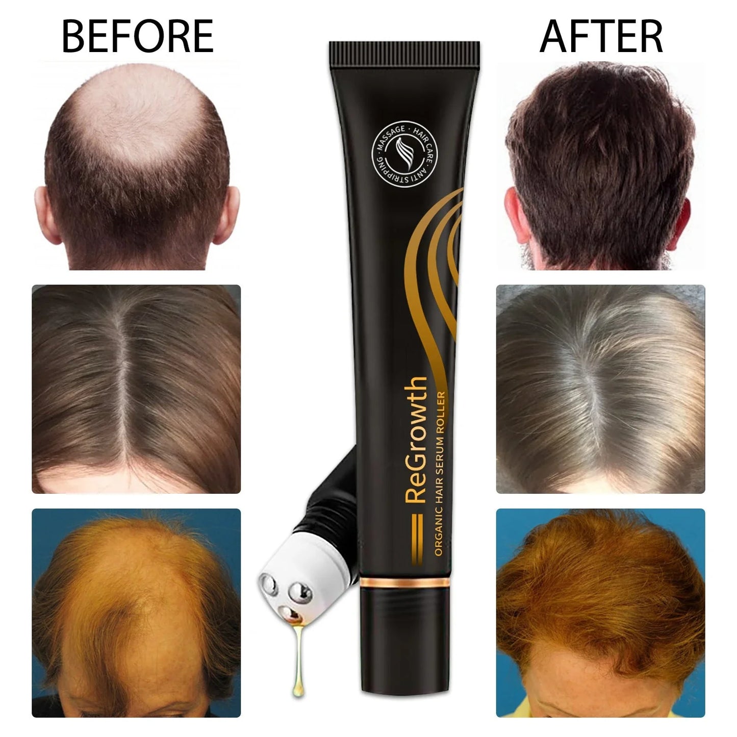 Nourishing Hair Growth Serum with Massage Roller - Revitalize Scalp, Reduce Hair Loss, Promote Healthy Hair Growth