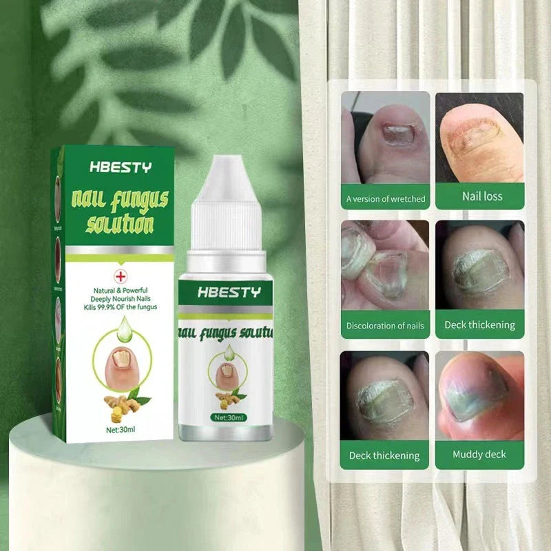 Premium Nail Fungus Treatment Gel with Honeysuckle and Hyaluronic Acid for Healthier, Revitalized Nails