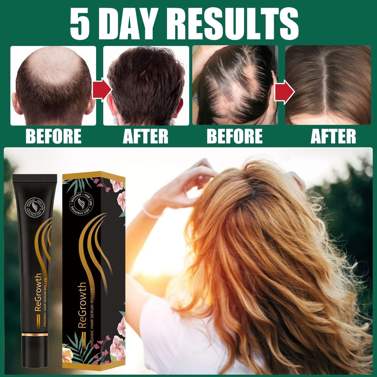 Nourishing Hair Growth Serum with Massage Roller - Revitalize Scalp, Reduce Hair Loss, Promote Healthy Hair Growth