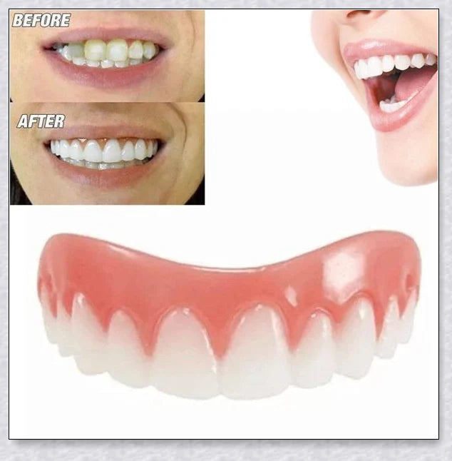 Premium teeth veneers that instantly transform your smile by concealing crooked, stained, or missing teeth