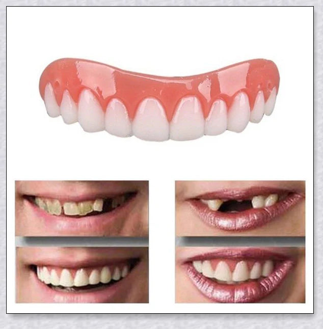 Premium teeth veneers that instantly transform your smile by concealing crooked, stained, or missing teeth