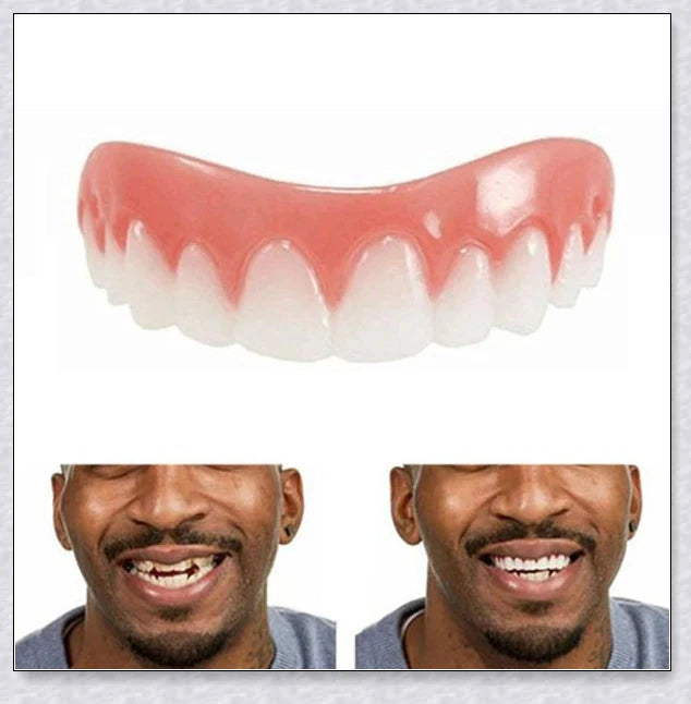 Premium teeth veneers that instantly transform your smile by concealing crooked, stained, or missing teeth