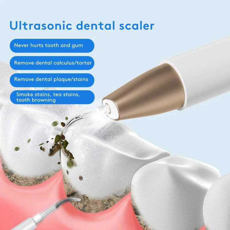 Gold-coloured ultrasonic tooth cleaner and tartar remover device with a stainless steel tip.
