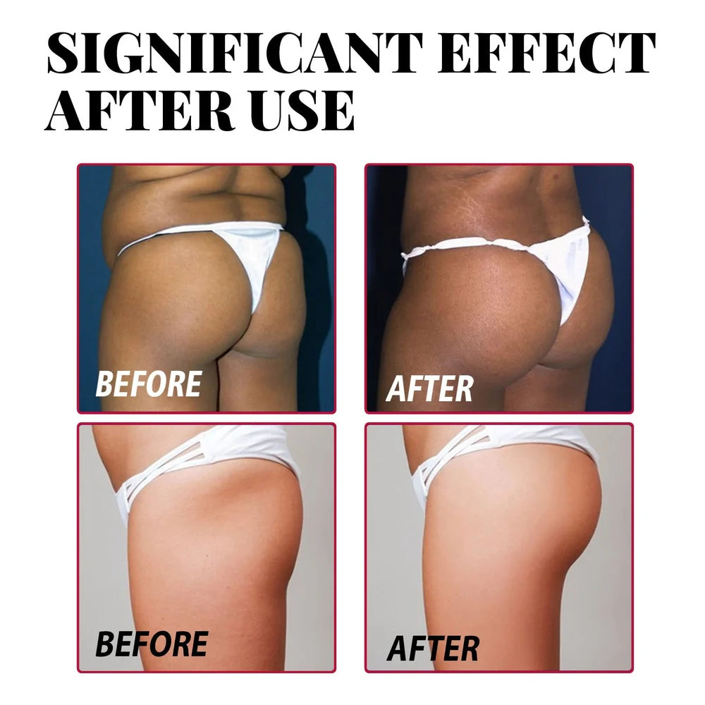 Plump buttock cream in 4.3x5cm packaging with 50g firming formula for daily application