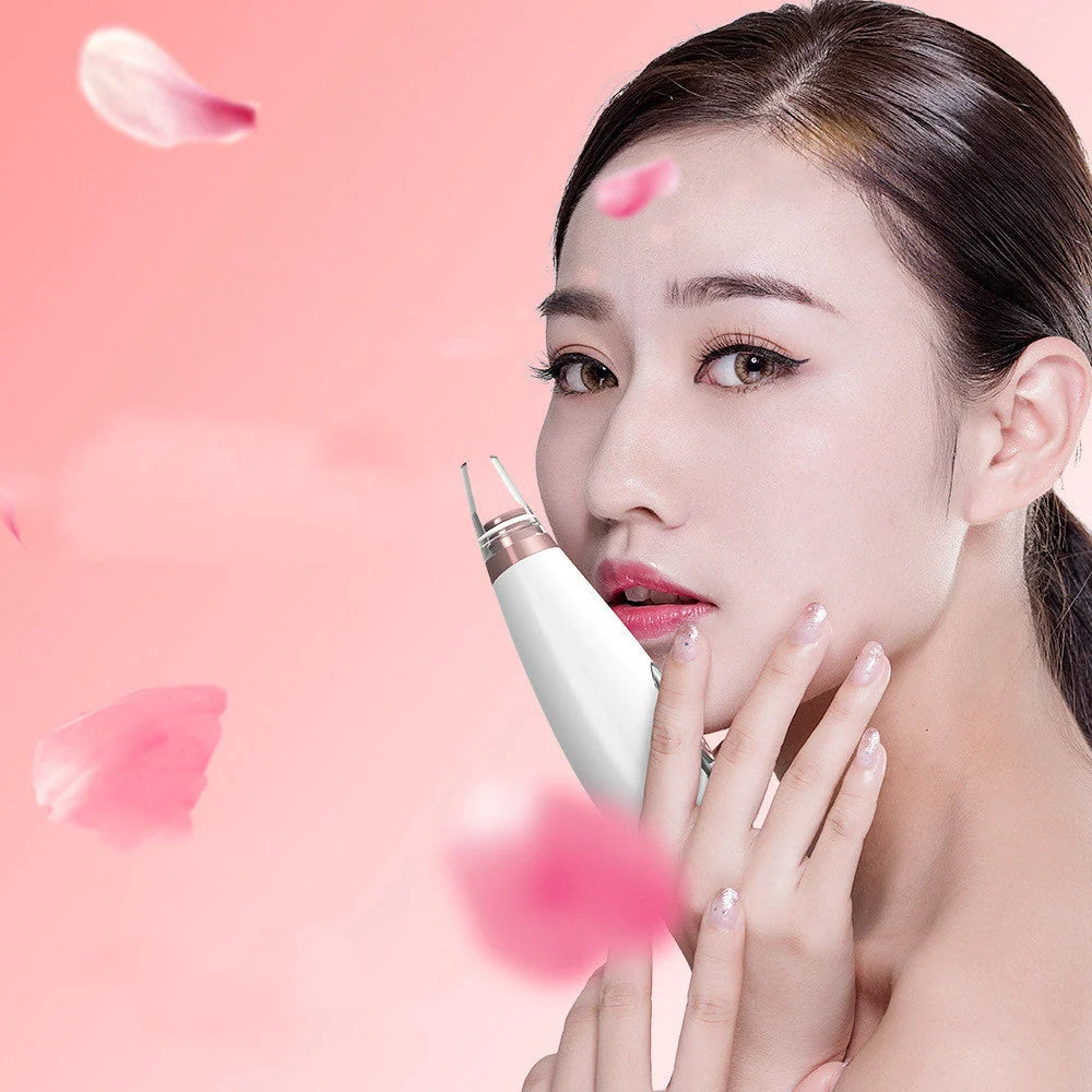Microcrystalline Blackhead Removal Device with powerful suction for deep pore cleansing and flawless skin