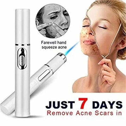 Advanced Blue Light Therapy Acne Pen - Targets Acne, Reduces Scarring, and Rejuvenates Skin