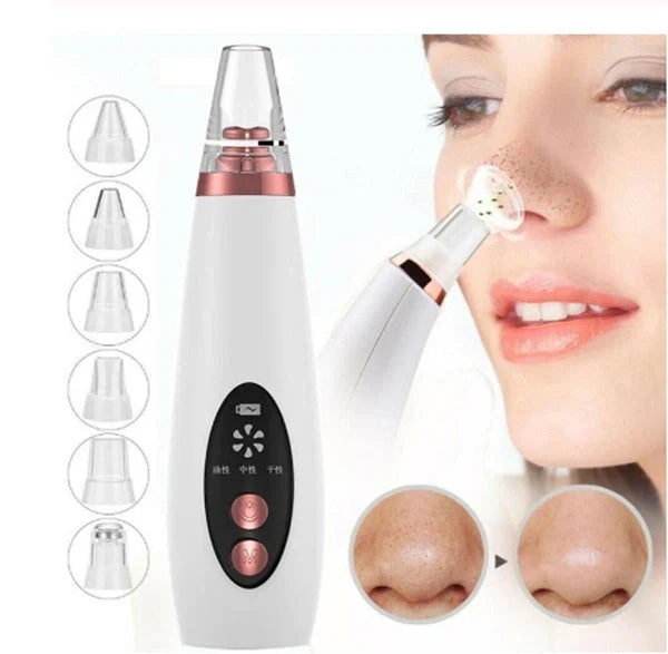 Microcrystalline Blackhead Removal Device with powerful suction for deep pore cleansing and flawless skin
