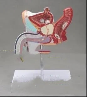 Detailed plastic anatomical model of male reproductive system showing pathologies including prostate enlargement.