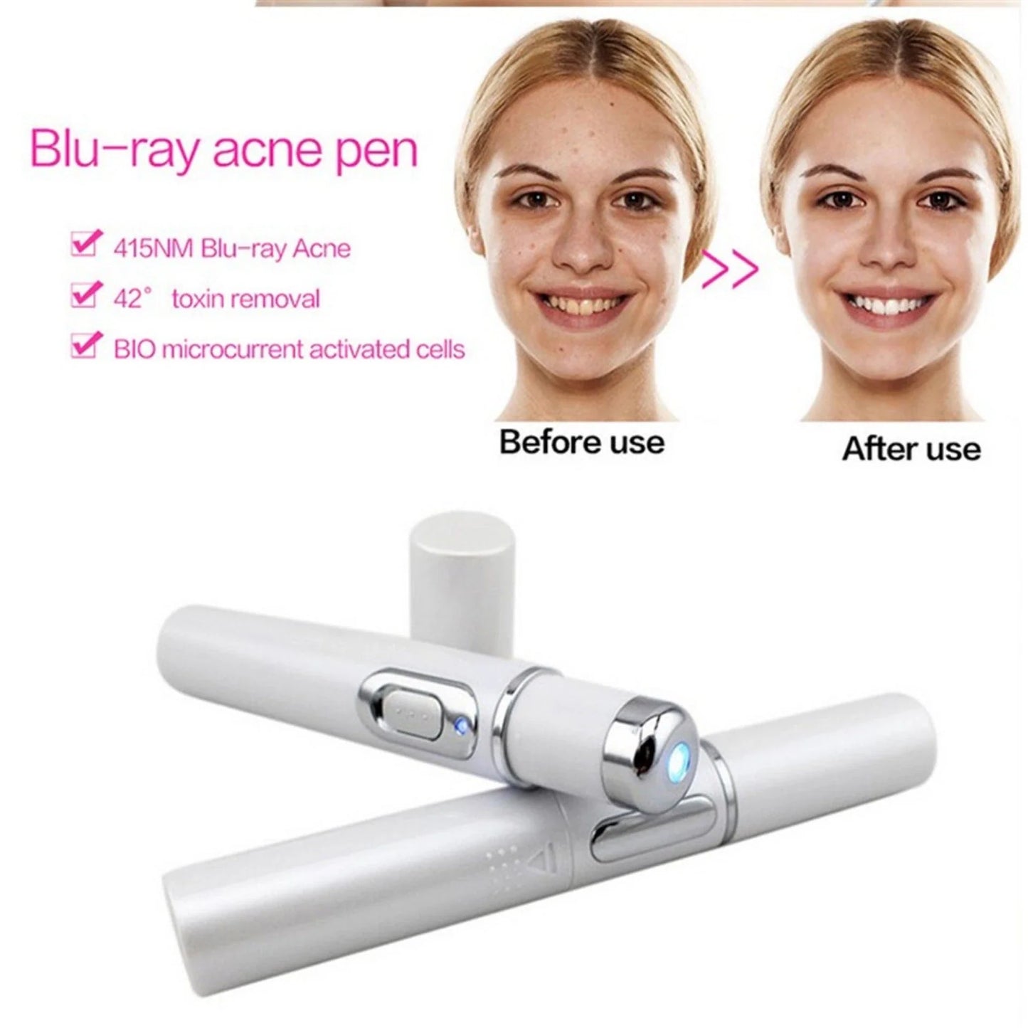 Advanced Blue Light Therapy Acne Pen - Targets Acne, Reduces Scarring, and Rejuvenates Skin