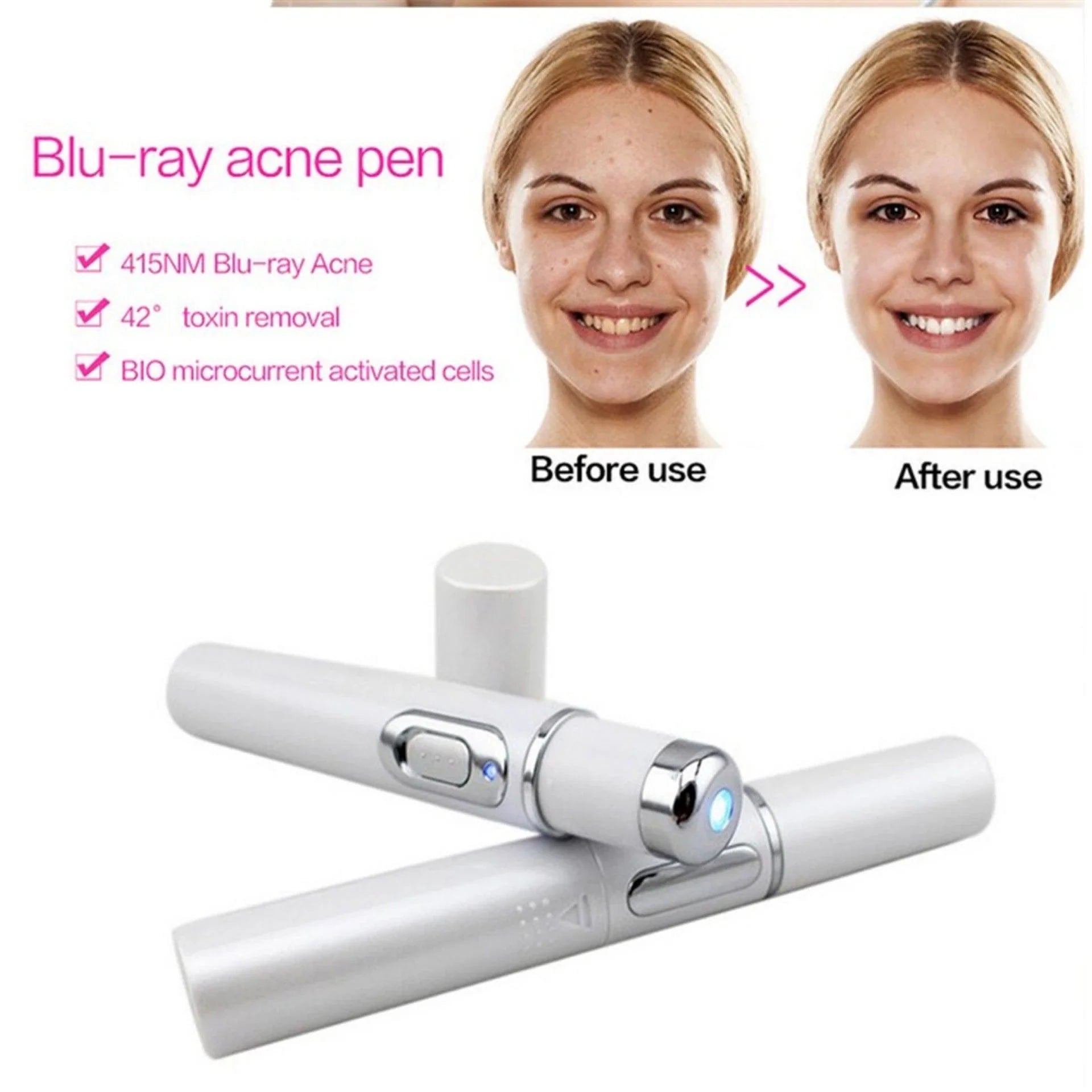 Advanced Blue Light Therapy Acne Pen - Targets Acne, Reduces Scarring, and Rejuvenates Skin
