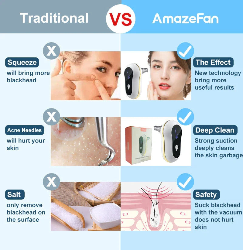 Electric facial pore cleanser with powerful suction for removing blackheads, whiteheads, and acne-causing impurities