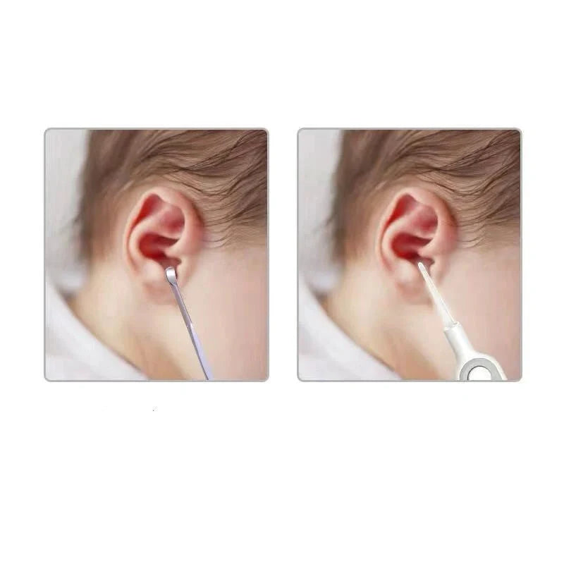Baby Ear Cleaner with luminous earpick for safe earwax removal, white color, battery-operated