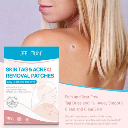 Skin Tag Remover Patches - Effectively remove skin tags without pain or scarring for flawless, radiant skin