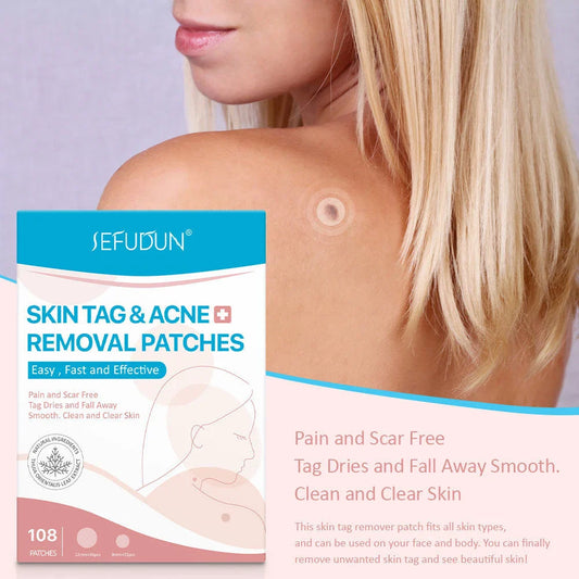 Skin Tag Remover Patches - Effectively remove skin tags without pain or scarring for flawless, radiant skin