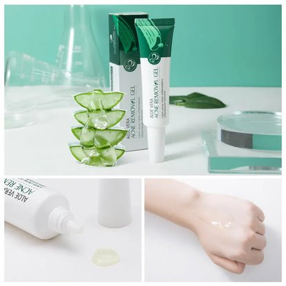 Green aloe acne treatment gel in Laiko Aloe Gel series with glycerin, 3-year shelf life