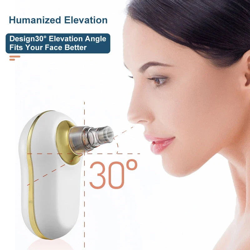 Electric facial pore cleanser with powerful suction for removing blackheads, whiteheads, and acne-causing impurities