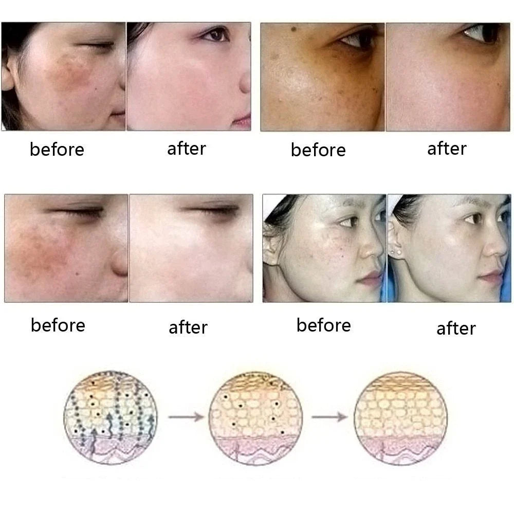 Skin-Perfecting Essence: Banish Blemishes, Brighten Complexion with Botanical-Infused Formula