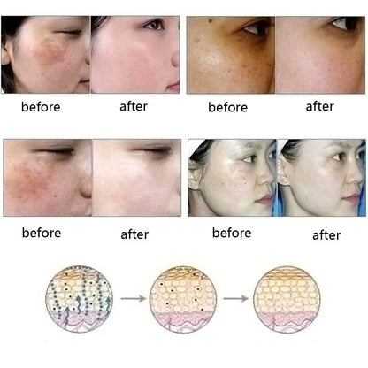 Skin-Perfecting Essence: Banish Blemishes, Brighten Complexion with Botanical-Infused Formula