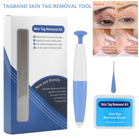 Premium Skin Tag Removal Kit - Safe, Painless Home Treatment for Moles, Warts and Other Skin Imperfections
