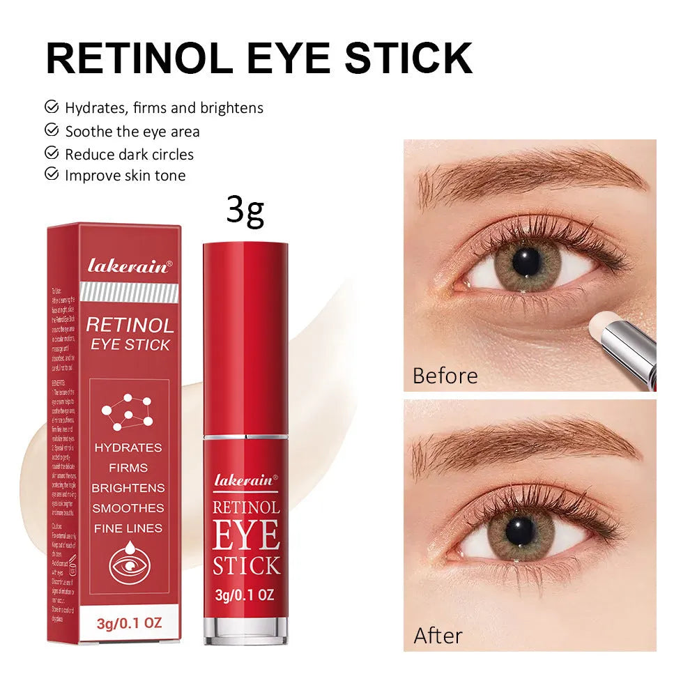 Retinol eye cream stick in packaging, net content 3g, for wrinkles and dark circles.