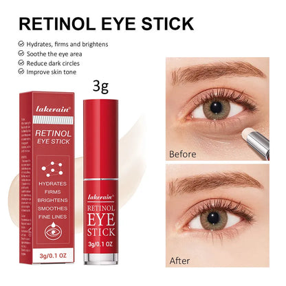 Retinol eye cream stick in packaging, net content 3g, for wrinkles and dark circles.