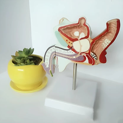 Detailed plastic anatomical model of male reproductive system showing pathologies including prostate enlargement.