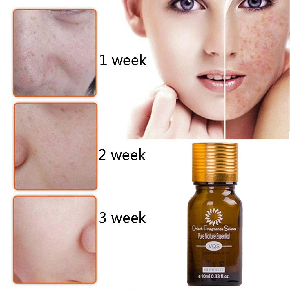 Skin-Perfecting Essence: Banish Blemishes, Brighten Complexion with Botanical-Infused Formula