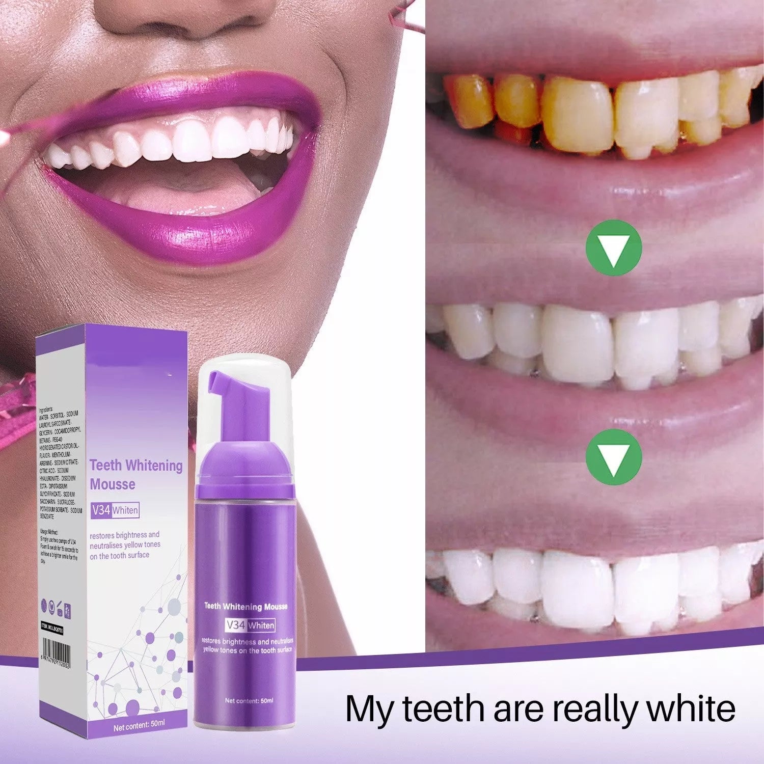 Oral Care Teeth Mousse for Smoke Stain Removal 50ml bottle