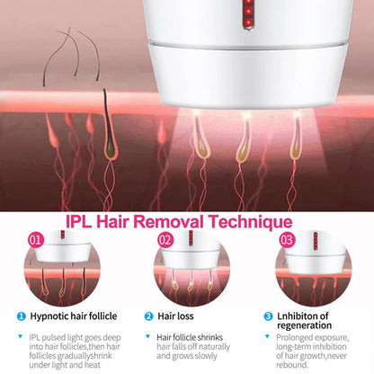 White home laser hair removal device with display, shown next to its power adapter.