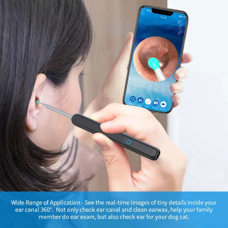 NE3 wireless otoscope ear wax removal tool with 1296P HD camera, LED light, and 360° wide-angle lens for iPhone and Android - visual ear cleaning kit with IPX5 waterproof rating and polymer battery
