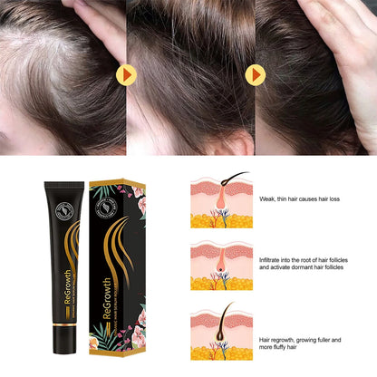 Nourishing Hair Growth Serum with Massage Roller - Revitalize Scalp, Reduce Hair Loss, Promote Healthy Hair Growth