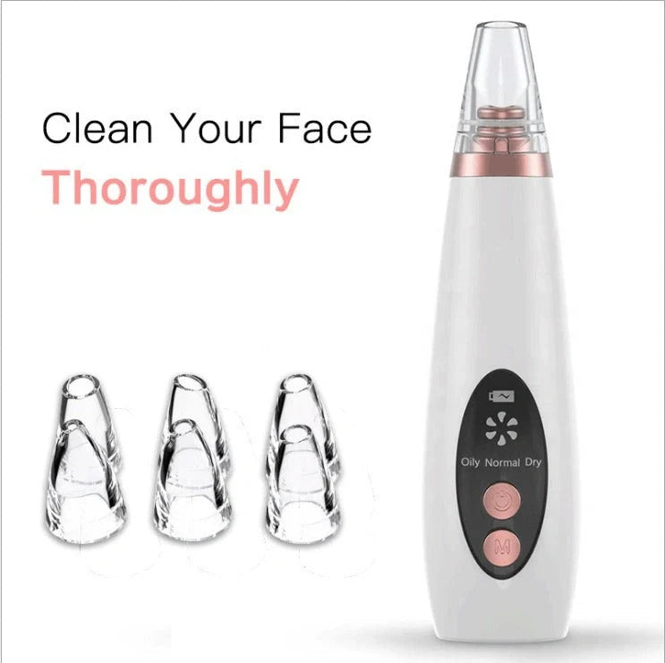 Microcrystalline Blackhead Removal Device with powerful suction for deep pore cleansing and flawless skin
