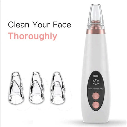 Microcrystalline Blackhead Removal Device with powerful suction for deep pore cleansing and flawless skin