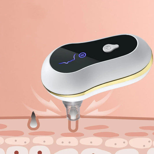 Electric facial pore cleanser with powerful suction for removing blackheads, whiteheads, and acne-causing impurities