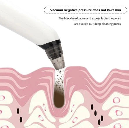 Blackhead suction instrument with oval, small round, and large round suction heads plus microcrystalline tip for facial treatment