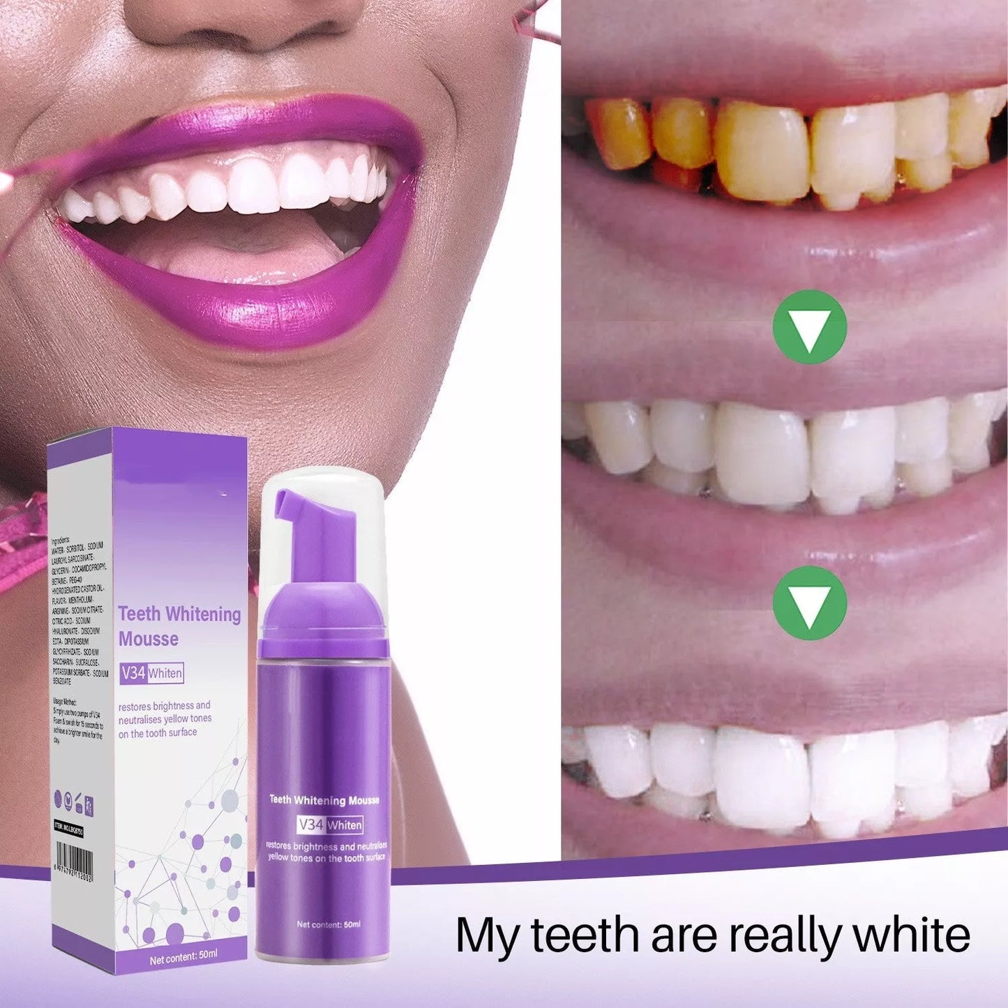 Oral Care Teeth Mousse for Smoke Stain Removal 50ml bottle