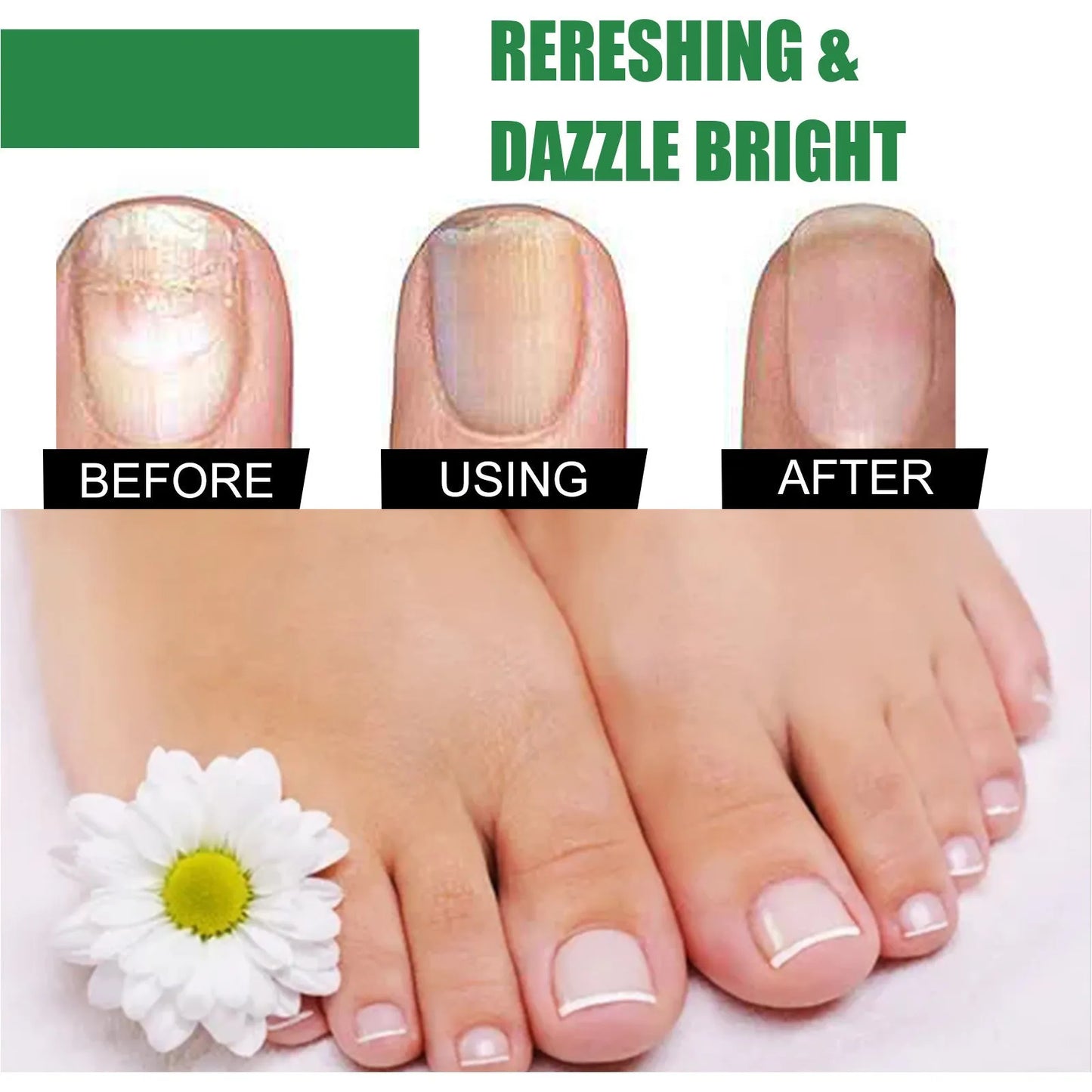 30ml bottle of tea tree oil nail repair fluid for hand and foot care.