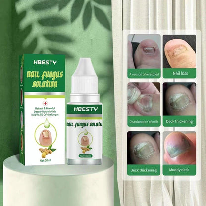 Premium Nail Fungus Treatment Gel with Honeysuckle and Hyaluronic Acid for Healthier, Revitalized Nails