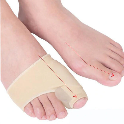 Big Foot Valgus Corrector in skin tone and white, designed for all-day wear and foot alignment correction