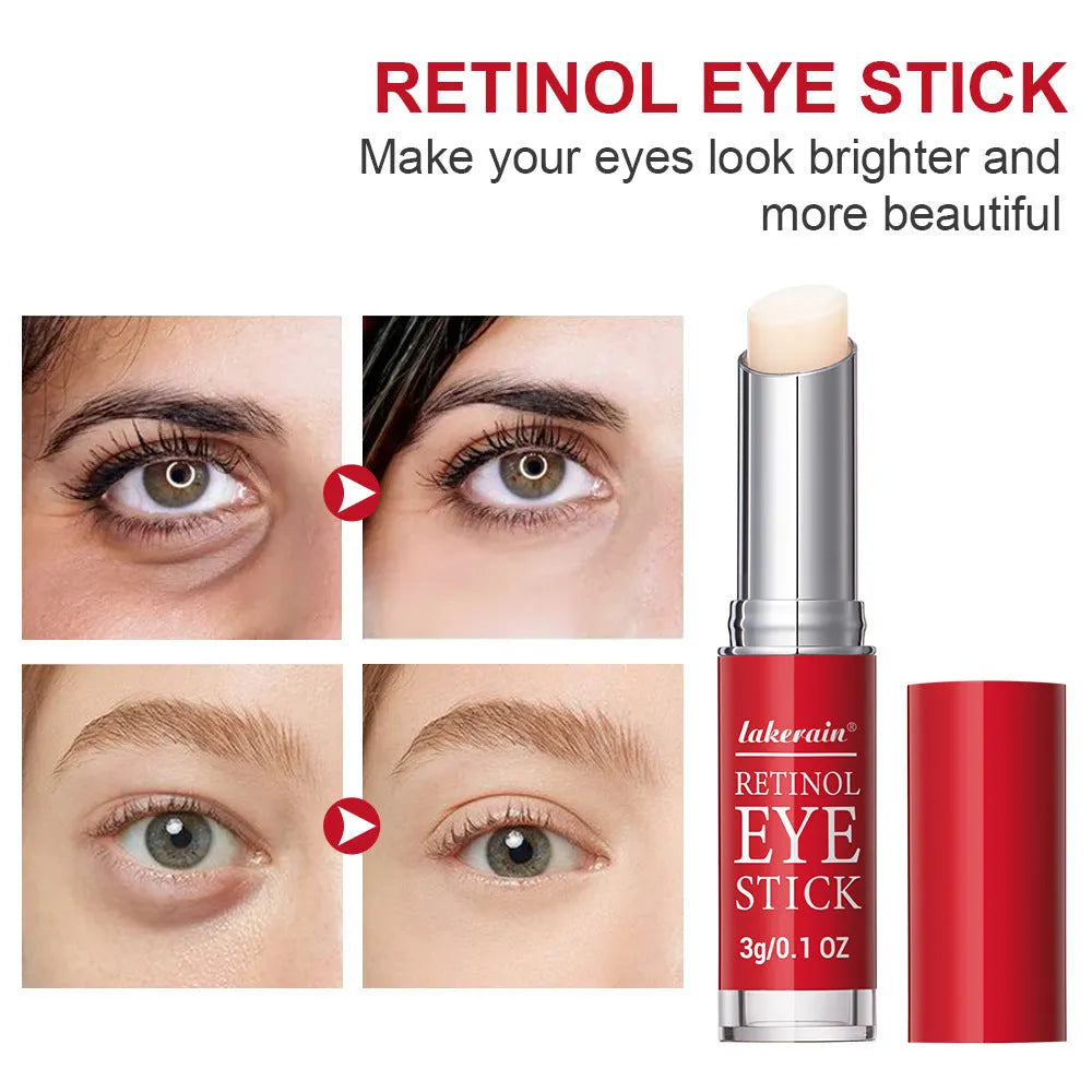 Retinol eye cream stick in packaging, net content 3g, for wrinkles and dark circles.