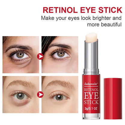 Retinol eye cream stick in packaging, net content 3g, for wrinkles and dark circles.