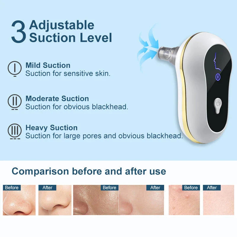 Electric facial pore cleanser with powerful suction for removing blackheads, whiteheads, and acne-causing impurities