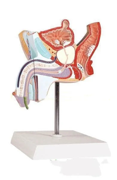 Detailed plastic anatomical model of male reproductive system showing pathologies including prostate enlargement.