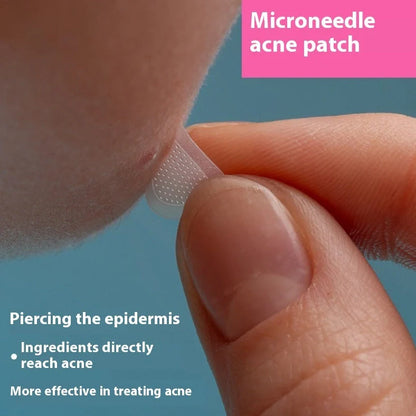 Soluble hyaluronic acid invisible microneedle acne patch sheet with 9 pieces in blister box