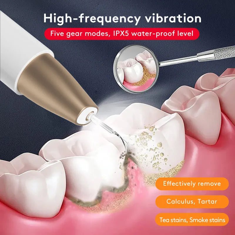 Gold-coloured ultrasonic tooth cleaner and tartar remover device with a stainless steel tip.