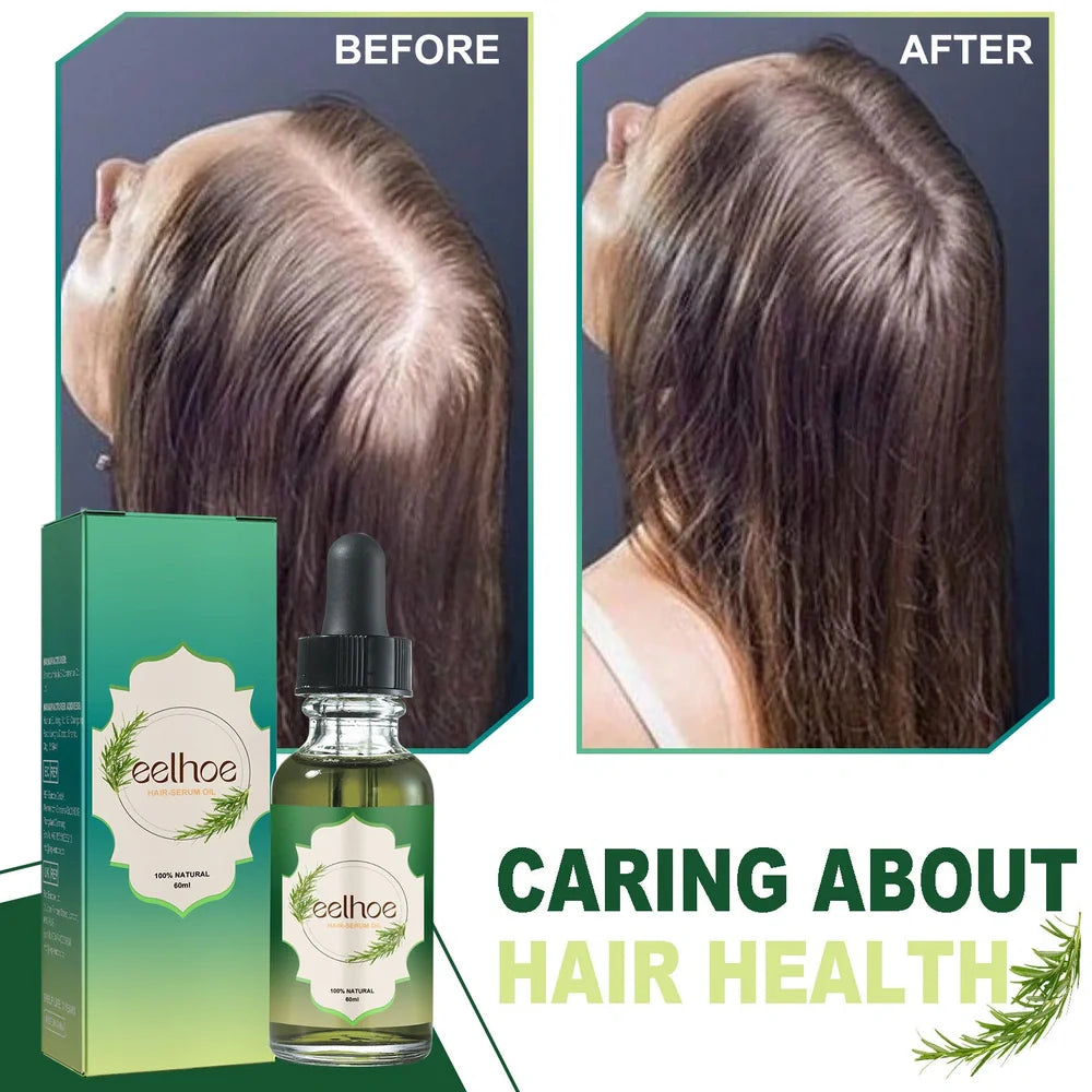 60ml rosemary hair essential oil bottle with dropper containing six natural oils