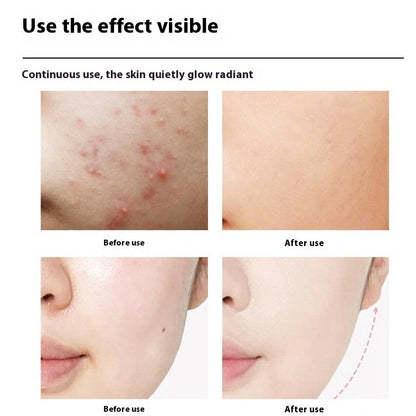 Pearl white skincare device with infrared and colour light functions, 15cm length