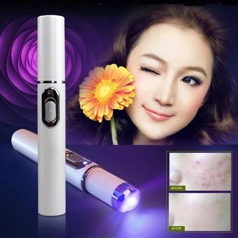 Advanced Blue Light Therapy Acne Pen - Targets Acne, Reduces Scarring, and Rejuvenates Skin